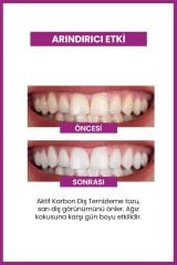 Luis Bien Diş Beyazlatıcı Toz Aktif Karbonlu 50 gr