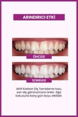 Luis Bien Diş Beyazlatma Seti Aktif Karbonlu Diş macunu 75 ml ve  Diş Tozu 50 gr